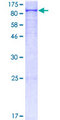 PLOD2 Protein - 12.5% SDS-PAGE of human PLOD2 stained with Coomassie Blue