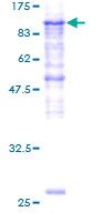 PLOD2 Protein - 12.5% SDS-PAGE of human PLOD2 stained with Coomassie Blue