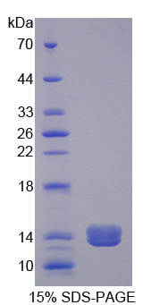 PLOD2 Protein - Recombinant Procollagen Lysine-2-Oxoglutarate-5-Dioxygenase 2 By SDS-PAGE