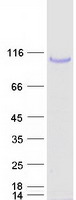 PLOD2 Protein - Purified recombinant protein PLOD2 was analyzed by SDS-PAGE gel and Coomassie Blue Staining