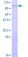 PLOD3 Protein - 12.5% SDS-PAGE of human PLOD3 stained with Coomassie Blue
