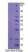 PLOD3 Protein - Recombinant Procollagen Lysine-2-Oxoglutarate-5-Dioxygenase 3 By SDS-PAGE