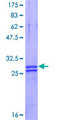 PLP1 / Myelin PLP Protein - 12.5% SDS-PAGE Stained with Coomassie Blue.
