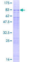 PLRG1 Protein - 12.5% SDS-PAGE of human PLRG1 stained with Coomassie Blue