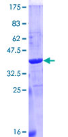 PLRG1 Protein - 12.5% SDS-PAGE Stained with Coomassie Blue.