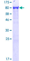 PLS3 / T Plastin Protein - 12.5% SDS-PAGE of human PLS3 stained with Coomassie Blue