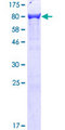 PLS3 / T Plastin Protein - 12.5% SDS-PAGE of human PLS3 stained with Coomassie Blue