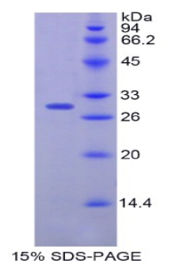 PLS3 / T Plastin Protein - Recombinant Plastin 3 By SDS-PAGE