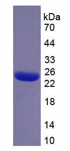 PLS3 / T Plastin Protein - Recombinant Plastin 3 By SDS-PAGE