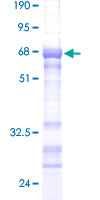 PLSCR3 Protein - 12.5% SDS-PAGE of human PLSCR3 stained with Coomassie Blue