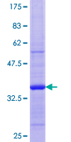 PLSCR3 Protein - 12.5% SDS-PAGE Stained with Coomassie Blue.