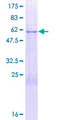 PLSCR4 Protein - 12.5% SDS-PAGE of human PLSCR4 stained with Coomassie Blue