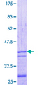 PLSCR4 Protein - 12.5% SDS-PAGE Stained with Coomassie Blue.