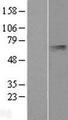 PLTP Protein - Western validation with an anti-DDK antibody * L: Control HEK293 lysate R: Over-expression lysate