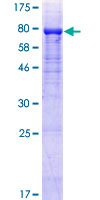 PLXDC2 Protein - 12.5% SDS-PAGE of human PLXDC2 stained with Coomassie Blue