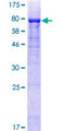 PLXDC2 Protein - 12.5% SDS-PAGE of human PLXDC2 stained with Coomassie Blue