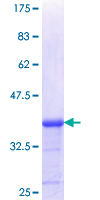 PLXDC2 Protein - 12.5% SDS-PAGE Stained with Coomassie Blue.