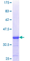 PLXDC2 Protein - 12.5% SDS-PAGE Stained with Coomassie Blue.