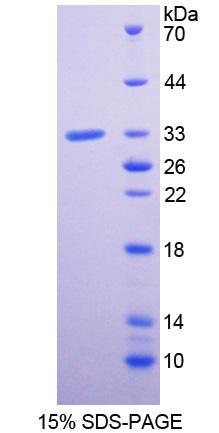 PLXNA1 / Plexin A1 Protein - Recombinant Plexin A1 By SDS-PAGE