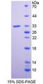 PLXNA1 / Plexin A1 Protein - Recombinant Plexin A1 By SDS-PAGE