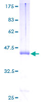 PLXNA2 / Plexin A2 Protein - 12.5% SDS-PAGE of human PLXNA2 stained with Coomassie Blue