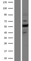 PLXNA4 / Plexin A4 Protein - Western validation with an anti-DDK antibody * L: Control HEK293 lysate R: Over-expression lysate
