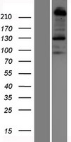 PLXNB1 / Plexin-B1 Protein - Western validation with an anti-DDK antibody * L: Control HEK293 lysate R: Over-expression lysate