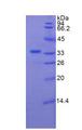 PLXNB1 / Plexin-B1 Protein - Recombinant Plexin B1 By SDS-PAGE