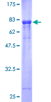 PLXNB2 / Plexin B2 Protein - 12.5% SDS-PAGE of human PLXNB2 stained with Coomassie Blue