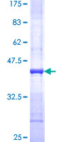 PLXNB2 / Plexin B2 Protein - 12.5% SDS-PAGE Stained with Coomassie Blue.