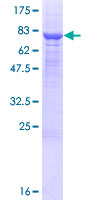 PM20D1 Protein - 12.5% SDS-PAGE of human PM20D1 stained with Coomassie Blue