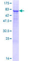 PM20D1 Protein - 12.5% SDS-PAGE of human PM20D1 stained with Coomassie Blue
