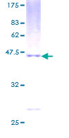 PMCH / MCH Protein - 12.5% SDS-PAGE of human PMCH stained with Coomassie Blue