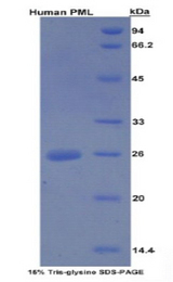 PML Protein - Recombinant Promyelocytic Leukemia Protein By SDS-PAGE