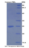 PML Protein - Recombinant Promyelocytic Leukemia Protein By SDS-PAGE