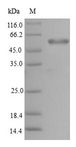 PMM2 Protein - (Tris-Glycine gel) Discontinuous SDS-PAGE (reduced) with 5% enrichment gel and 15% separation gel.