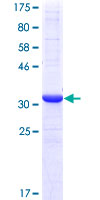 PMM2 Protein - 12.5% SDS-PAGE Stained with Coomassie Blue.