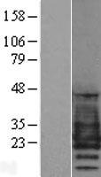 PMP22 Protein - Western validation with an anti-DDK antibody * L: Control HEK293 lysate R: Over-expression lysate
