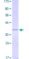 PMP22 Protein - 12.5% SDS-PAGE of human PMP22 stained with Coomassie Blue