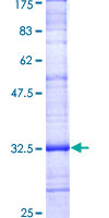 PMP22 Protein - 12.5% SDS-PAGE Stained with Coomassie Blue.