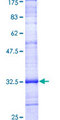 PMP22 Protein - 12.5% SDS-PAGE Stained with Coomassie Blue.