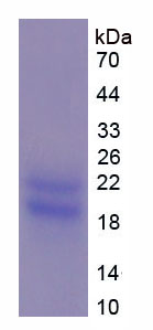 PMP22 Protein - Recombinant Peripheral Myelin Protein 22 By SDS-PAGE