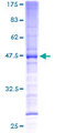 PMP70 Protein - 12.5% SDS-PAGE of human ABCD3 stained with Coomassie Blue