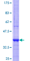 PMP70 Protein - 12.5% SDS-PAGE Stained with Coomassie Blue.
