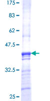 PMPCB / MPP11 Protein - 12.5% SDS-PAGE Stained with Coomassie Blue.