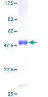 PMVK Protein - 12.5% SDS-PAGE of human PMVK stained with Coomassie Blue