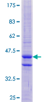 PNCK / CaMK1b Protein - 12.5% SDS-PAGE of human PNCK stained with Coomassie Blue