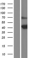 PNKD Protein - Western validation with an anti-DDK antibody * L: Control HEK293 lysate R: Over-expression lysate