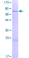 PNKD Protein - 12.5% SDS-PAGE of human PNKD stained with Coomassie Blue