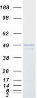 PNKD Protein - Purified recombinant protein PNKD was analyzed by SDS-PAGE gel and Coomassie Blue Staining